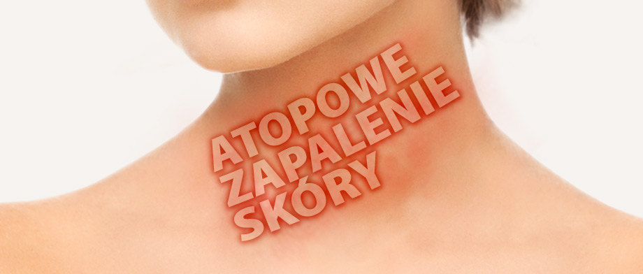 Atopowe zapalenie skóry