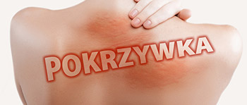 Pokrzywka